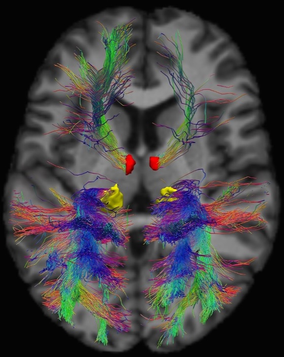 Thalamic tractography